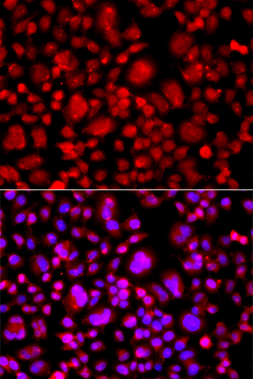 Anti-TP53BP2 Antibody (CAB5704)