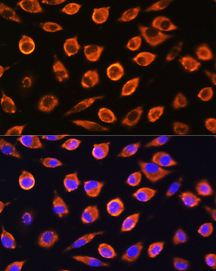 Anti-RND1 Antibody (CAB13705)