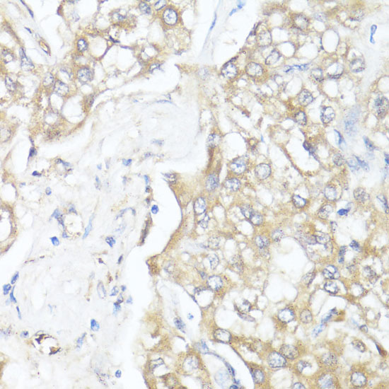 Anti-Smad7 Antibody (CAB16396)