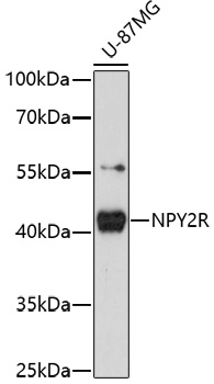 Anti-NPY2R Antibody (CAB16934)