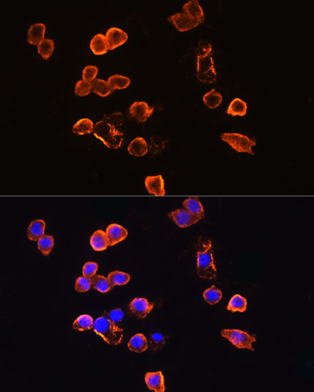 Anti-CD14 Antibody (CAB5737)