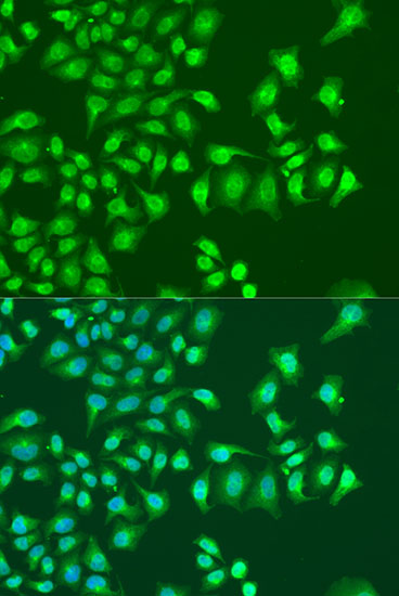 Anti-NIN Antibody (CAB12734)