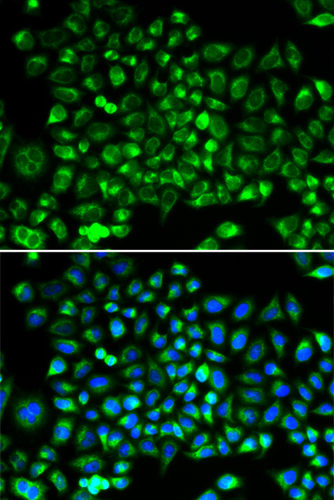 Anti-DRP1 Antibody (CAB2586)