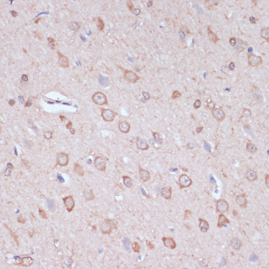 Anti-CARTPT Antibody (CAB18275)