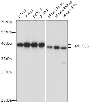 Anti-MRPS35 Antibody (CAB15878)