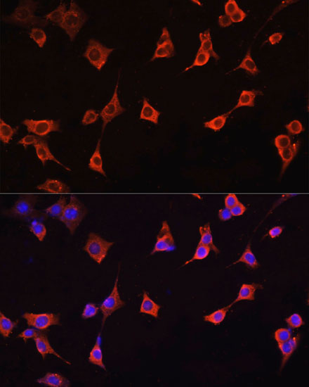 Anti-CFL1 Antibody (CAB1704)