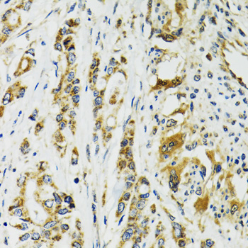 Anti-TNNC1 Antibody (CAB1927)