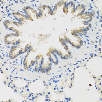 Anti-TICAM1 Antibody (CAB13605)