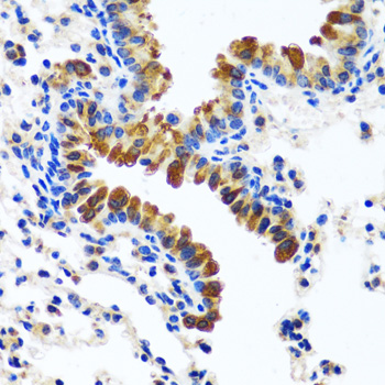 Anti-CAMLG Antibody (CAB13720)