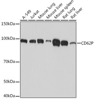 Anti-CD62P Antibody (CAB4989)