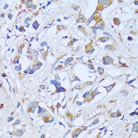 Anti-ACADSB Antibody (CAB15019)