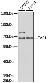 Anti-TAP1 Antibody (CAB6213)