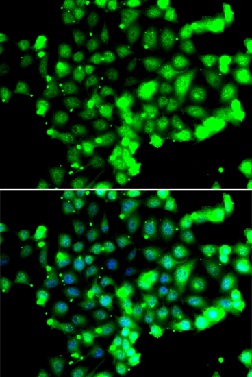 Anti-FASTK Antibody (CAB7069)