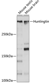 Anti-Huntingtin Antibody (CAB19064)