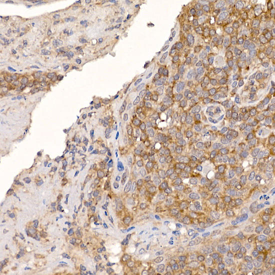 Immunohistochemistry of paraffin-embedded human tonsil using ERp19 Rabbit mAb at dilution of 1:200 (40x lens). Perform high pressure antigen retrieval with 10 mM citrate buffer pH 6. 0 before commencing with IHC staining protocol.