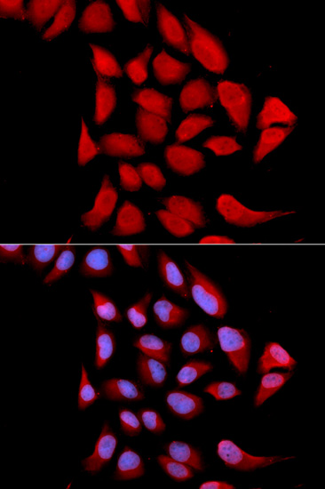 Anti-PSMA6 Antibody (CAB2188)