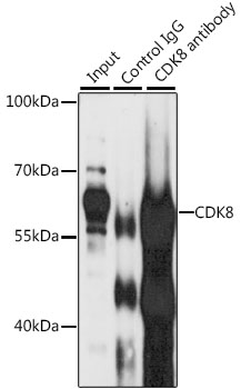 Anti-CDK8 Antibody [KO Validated] (CAB5548)