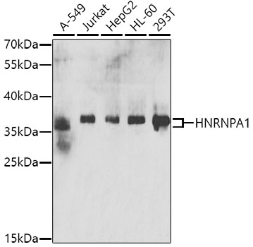 Anti-HNRNPA1 Antibody (CAB7491)