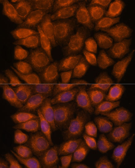 Anti-SNX15 Polyclonal Antibody (CAB9158)