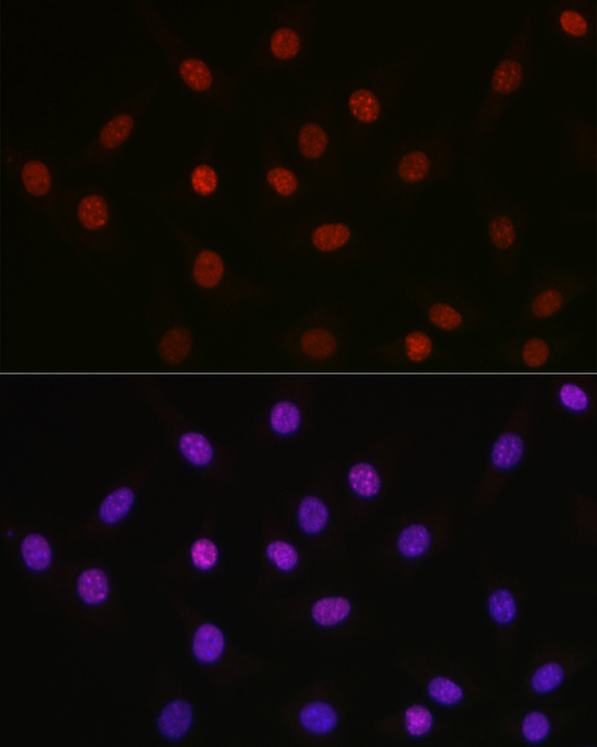 Anti-Acetyl-HMGB1-K29 Antibody [KO Validated] (CAB16002)