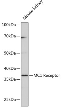 Anti-MC1 Receptor[KO Validated] Antibody