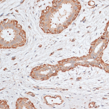 Anti-ABCC5 Antibody (CAB11978)