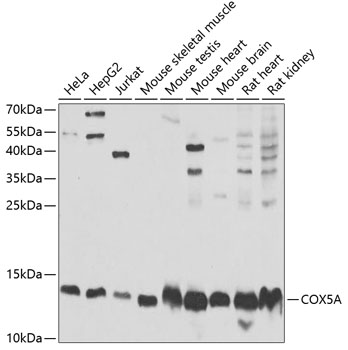 Anti-COX5A Antibody (CAB6437)