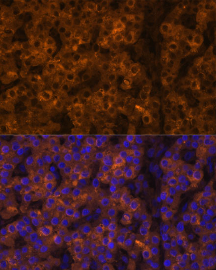 Anti-TTR Antibody (CAB1120)