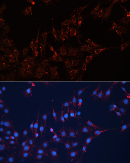 Anti-GNAI2 Antibody (CAB14547)