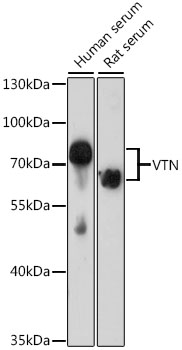 Anti-VTN Antibody (CAB1667)