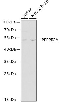 Anti-PPP2R2A Antibody (CAB2185)