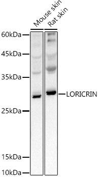 Western blot analysis of extracts of various cell lines, using LORICRIN antibody at 1:1000 dilution. Secondary antibody: HRP Goat Anti-Rabbit IgG (H+L) at 1:10000 dilution. Lysates/proteins: 25ug per lane. Blocking buffer: 3% nonfat dry milk in TBST. Detection: ECL Basic Kit. Exposure time: 3s.