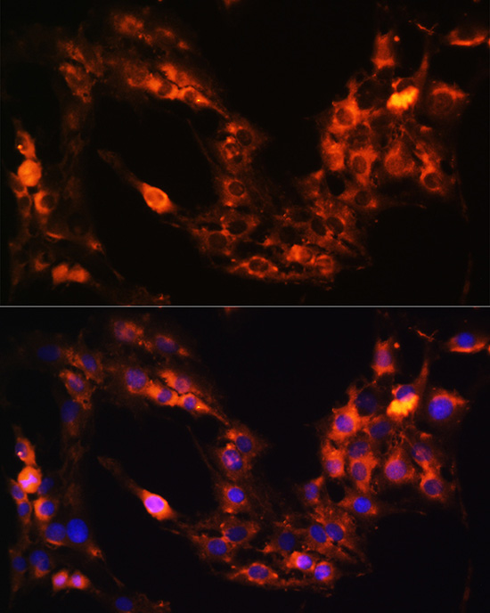 Anti-GRM1 Antibody (CAB11094)