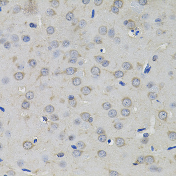 Anti-AMPD1 Antibody (CAB7876)