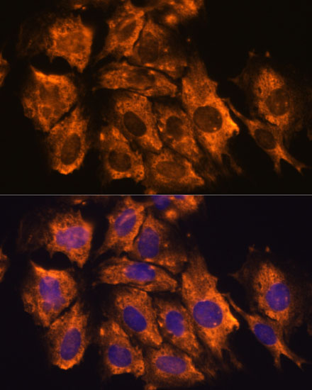 Anti-CRELD1 Antibody (CAB15186)