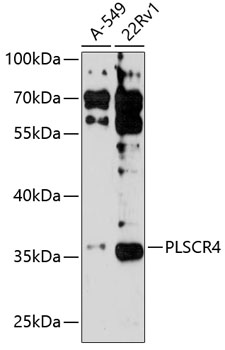 Anti-PLSCR4 Antibody (CAB14670)