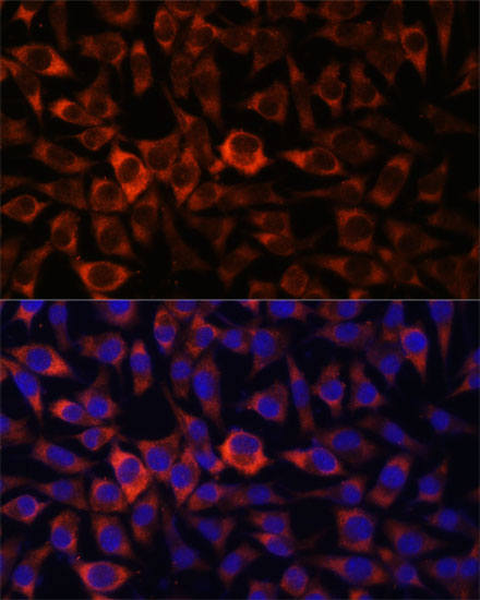 Anti-HEBP2 Antibody (CAB16504)