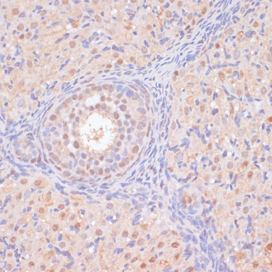 Anti-BYSL Antibody (CAB11993)