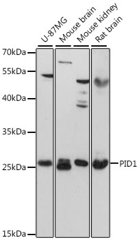 Anti-PID1 Antibody (CAB13220)