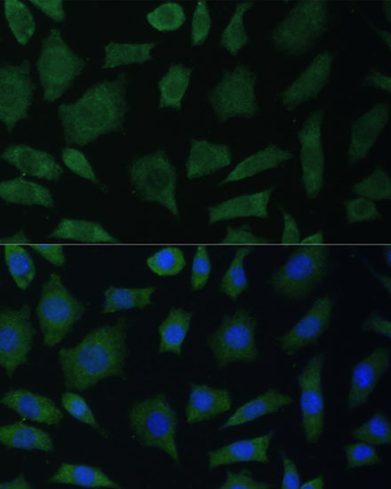 Anti-PTK2B Antibody (CAB16045)