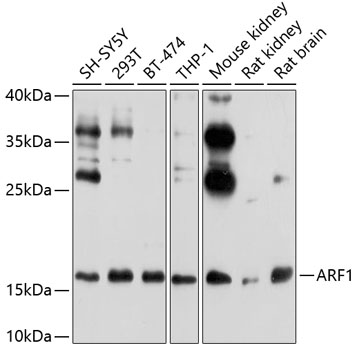 Anti-ARF1 Antibody (CAB7643)