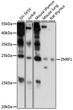 Anti-ZNRF1 Antibody (CAB15918)