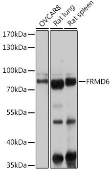 Anti-FRMD6 Polyclonal Antibody (CAB9995)