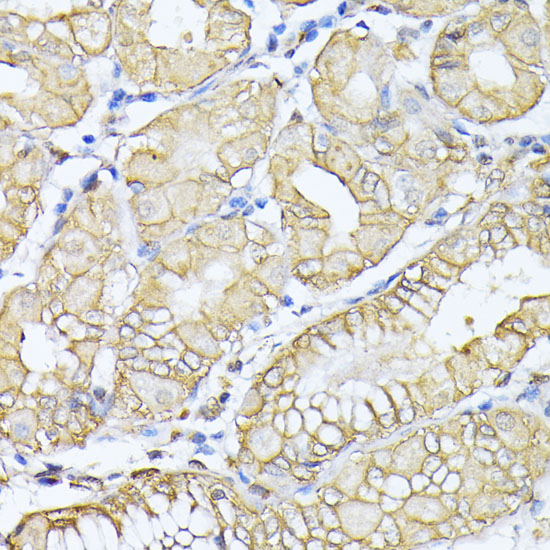 Anti-SPTAN1 Antibody (CAB0160)