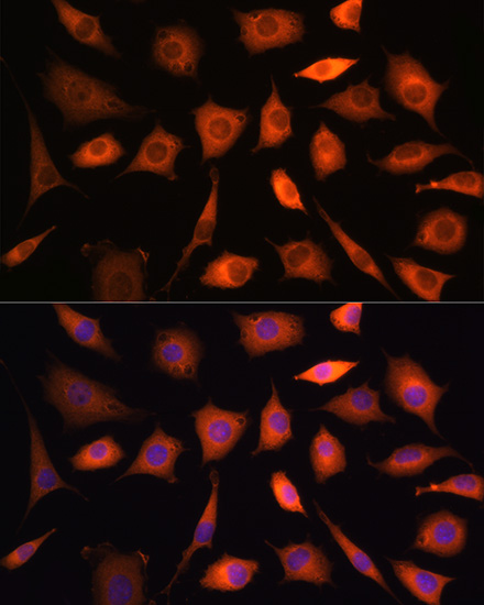 Anti-PHGDH Antibody (CAB10461)