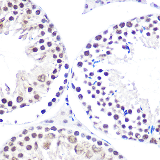 Anti-NELFE Antibody (CAB3249)