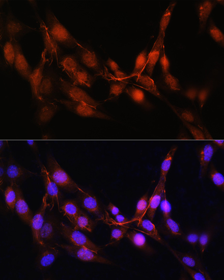 Anti-ADK Antibody (CAB15024)