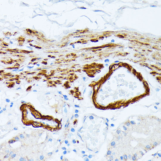 Anti-TPM2 Antibody (CAB3096)