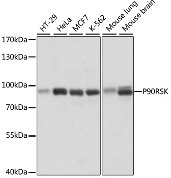 Anti-P90RSK Antibody (CAB15718)