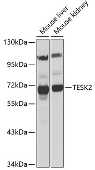 Anti-TESK2 Antibody (CAB7460)